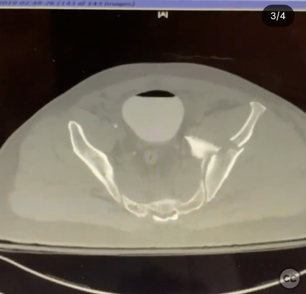 case image