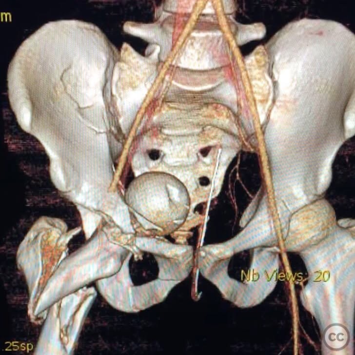 case image