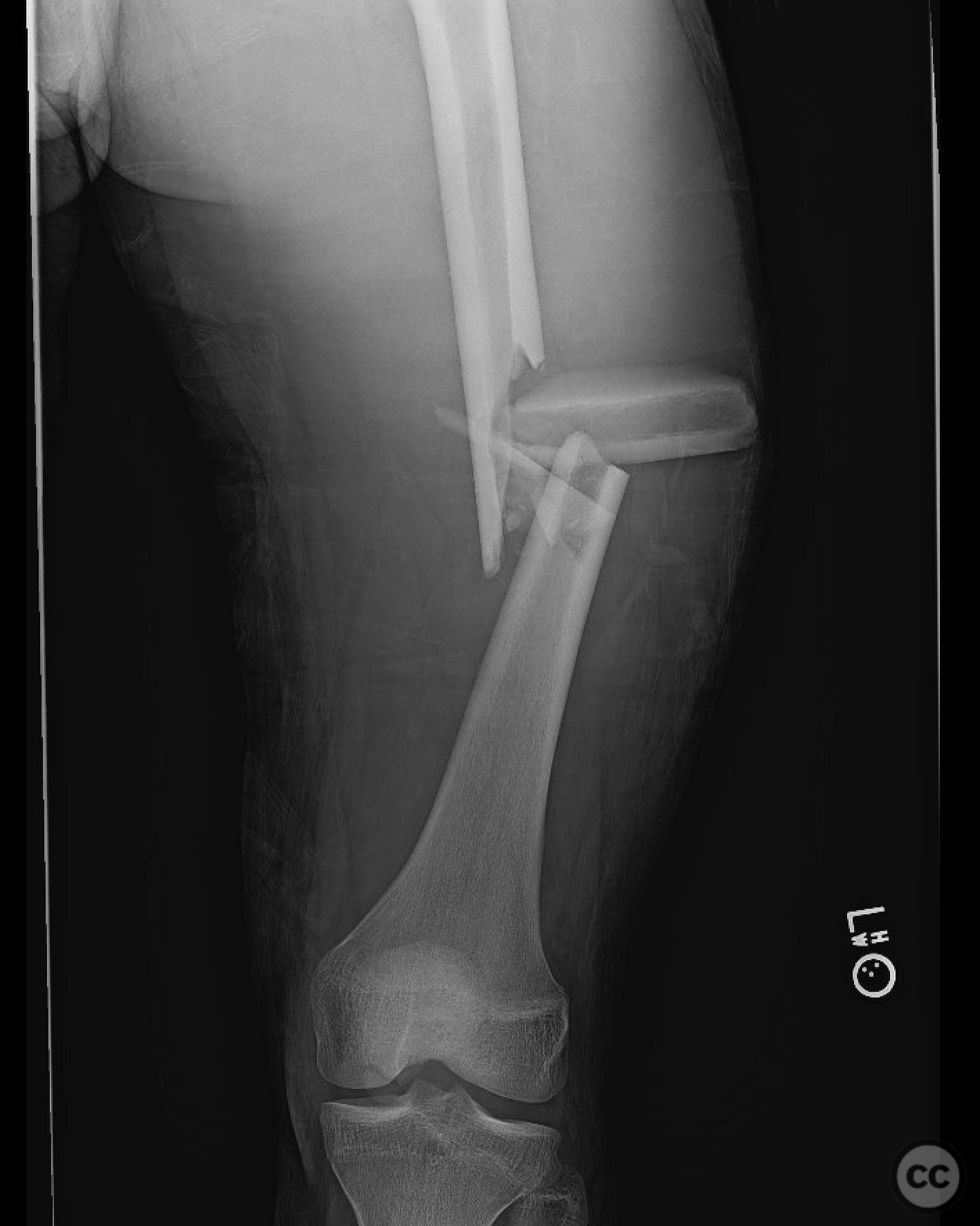 case image