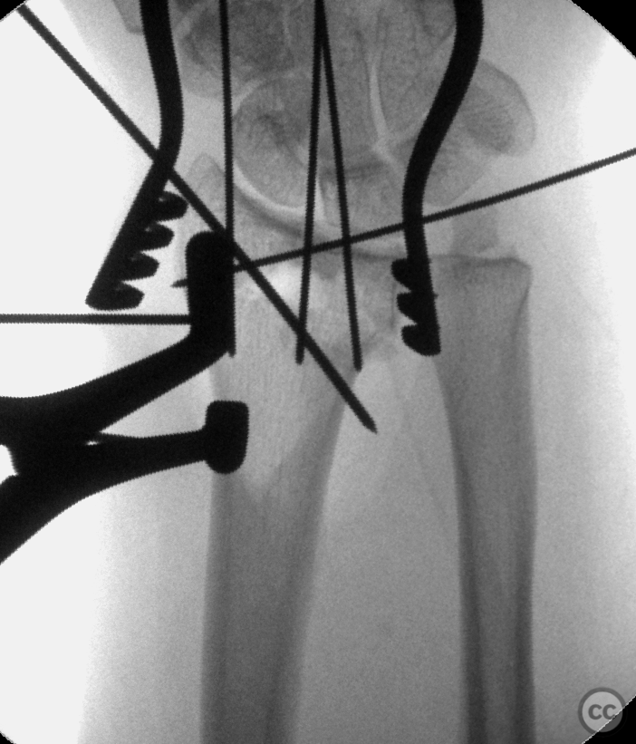 case image