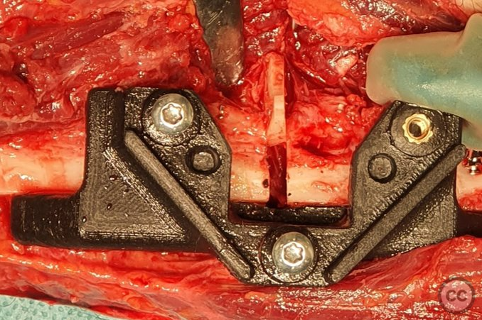 case image