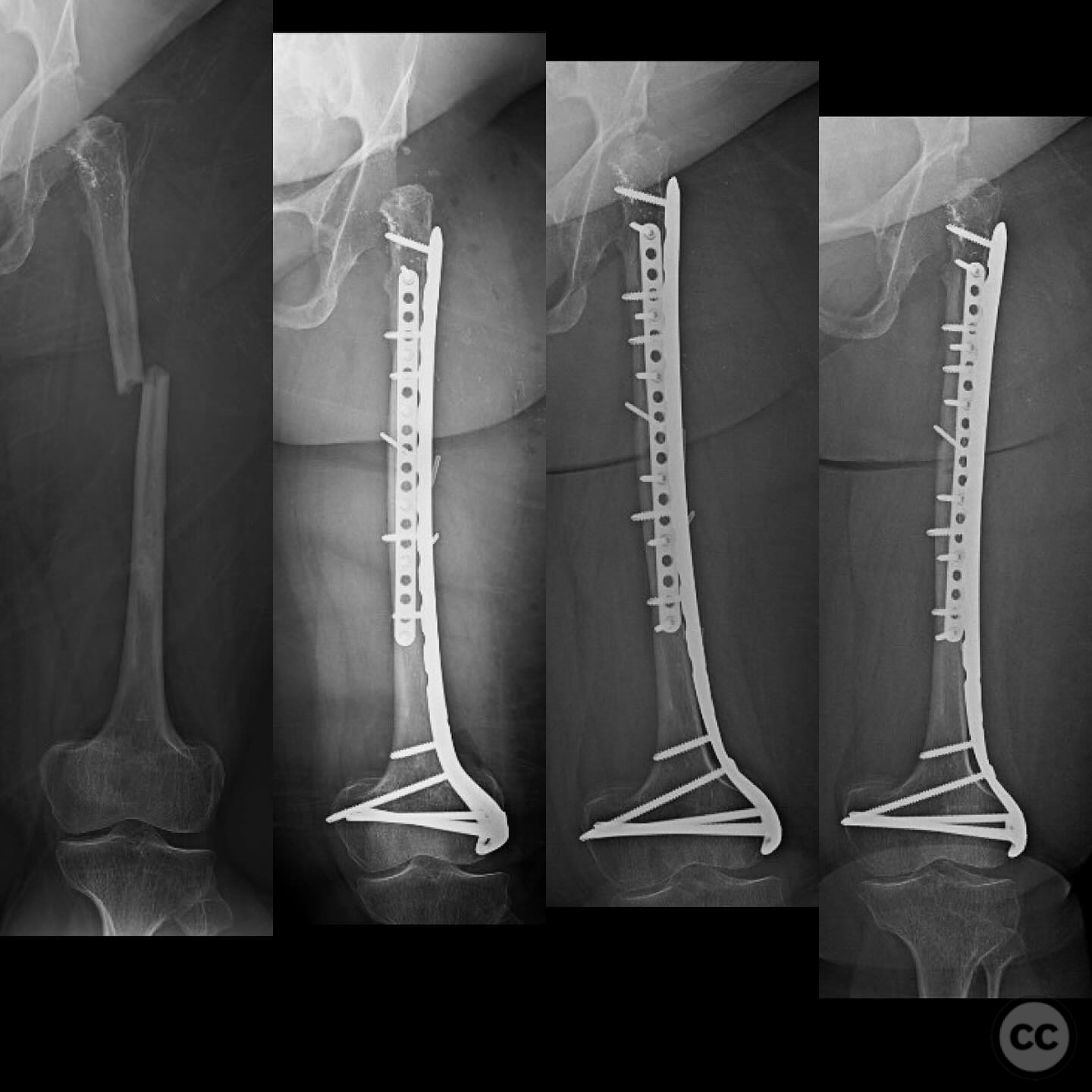 case image