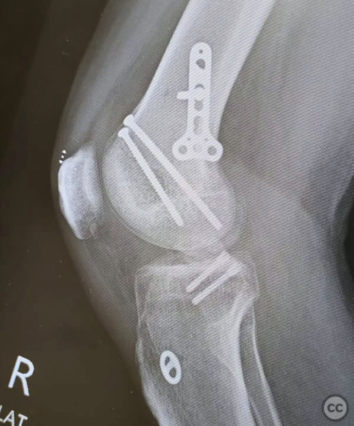 case image