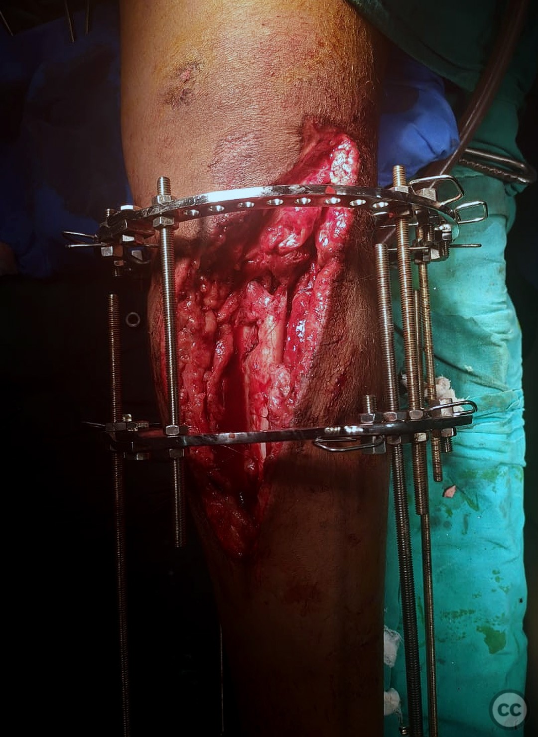 case image