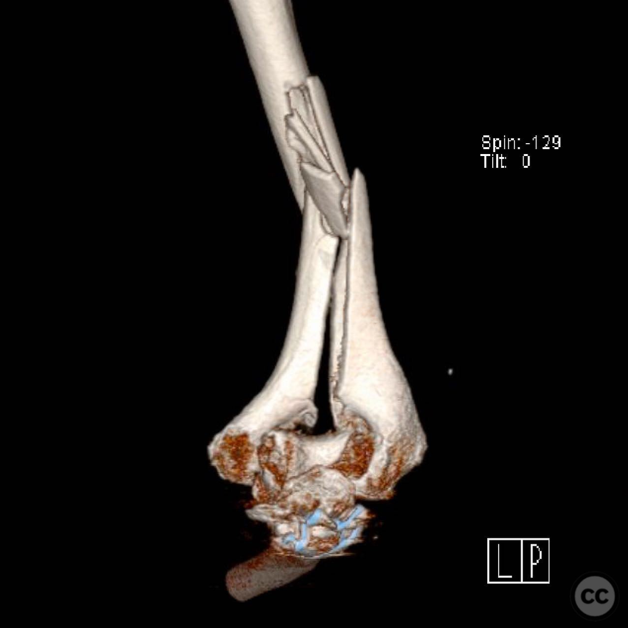 case image