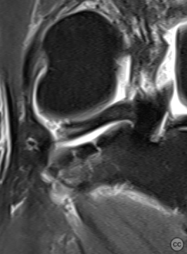 case image