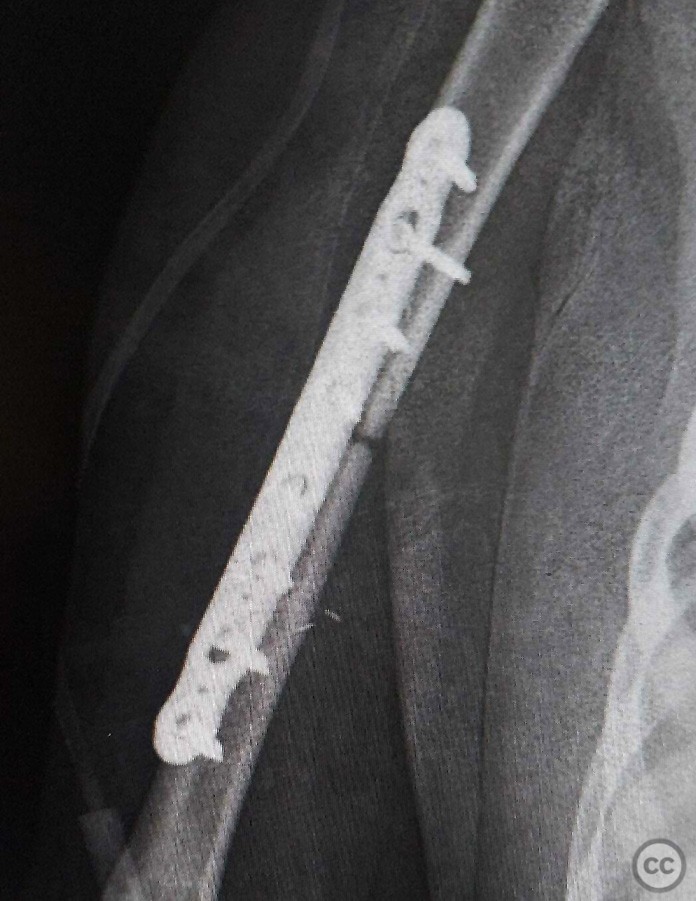 case image