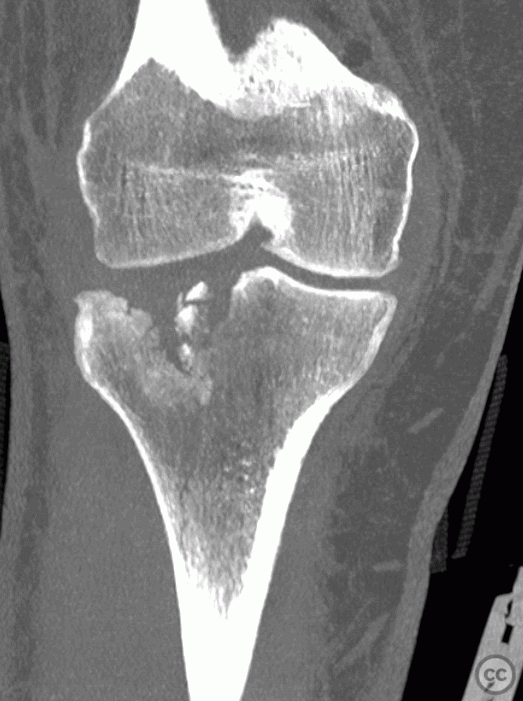 case image