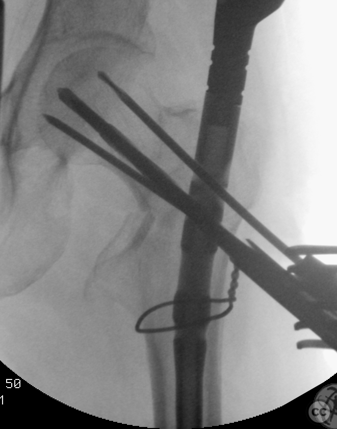 case image
