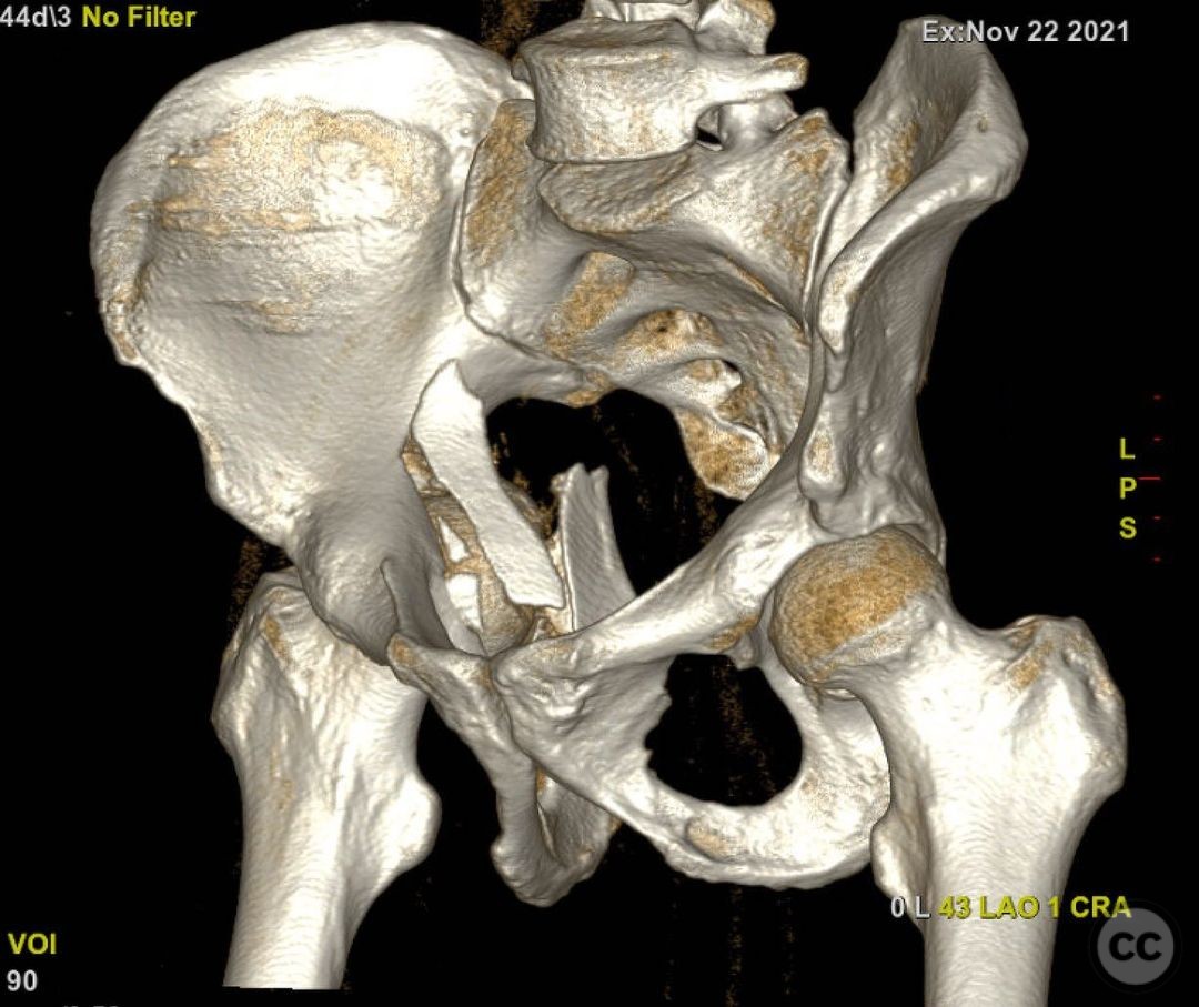 case image