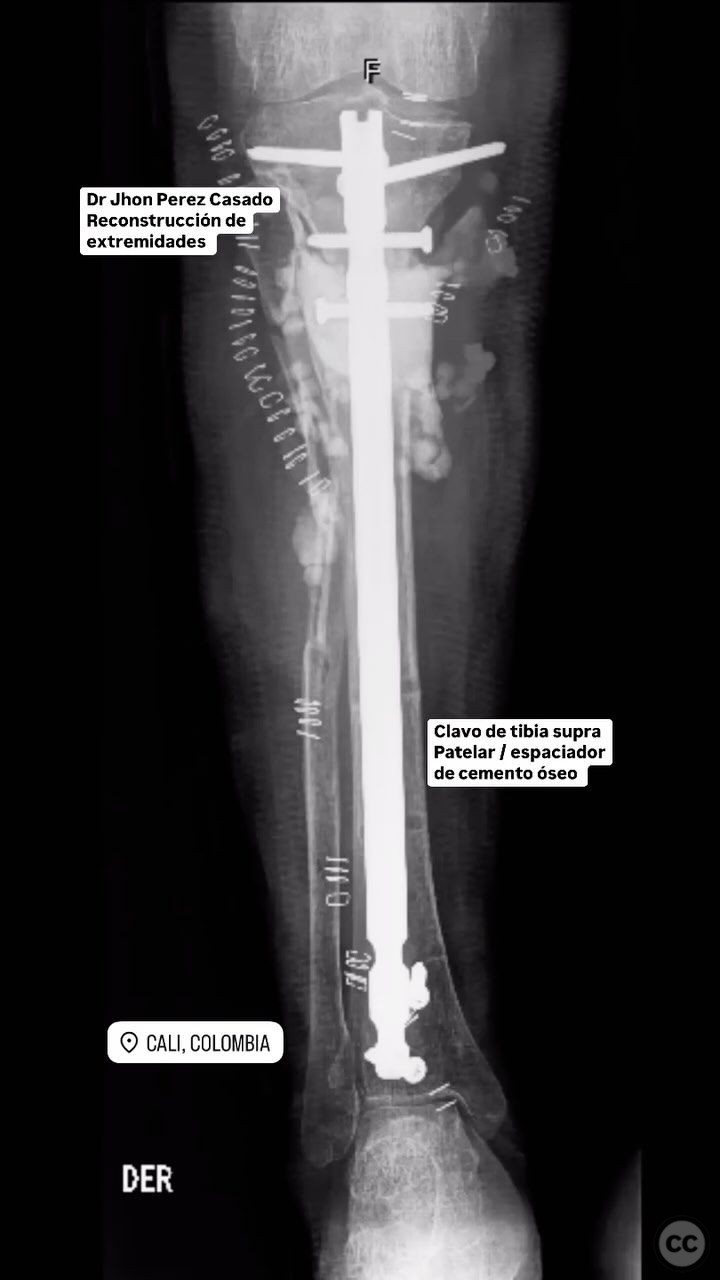 case image
