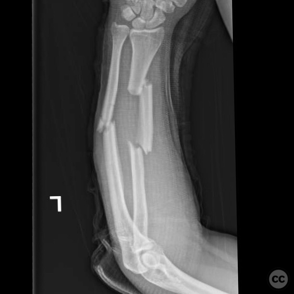 case image