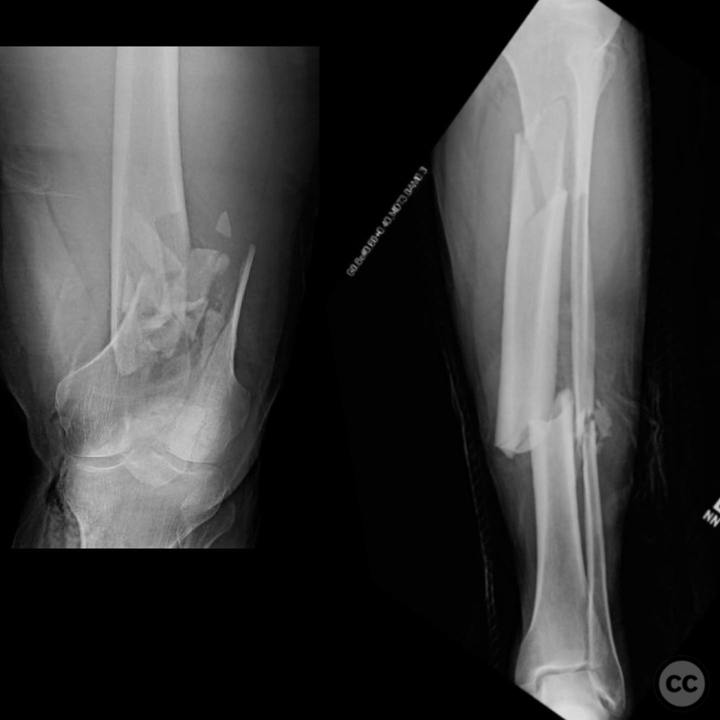 case image